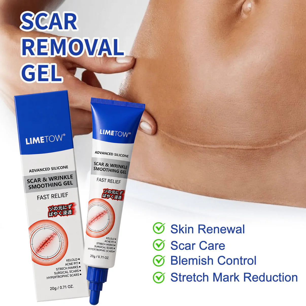 Advanced Silicone Scar & Wrinkle Smoothing Gel