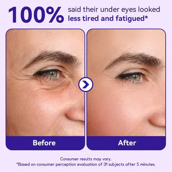 Instant Lift Eye Gel — Reduce the Look of Eye Bags in Minutes 🔥