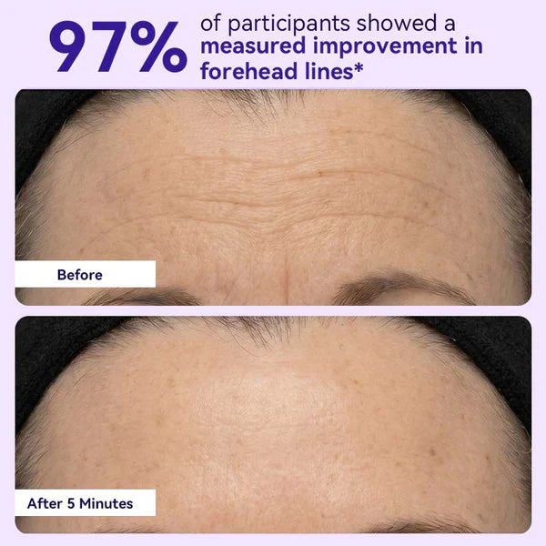 Instant Lift Eye Gel — Reduce the Look of Eye Bags in Minutes 🔥