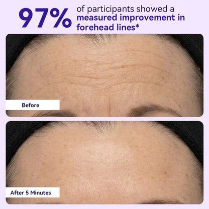 Instant Lift Eye Gel — Reduce the Look of Eye Bags in Minutes 🔥