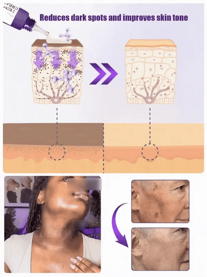 Highly effective whitening and spot-lightening cream